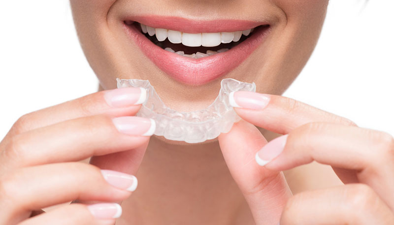 歯ぎしり治療について