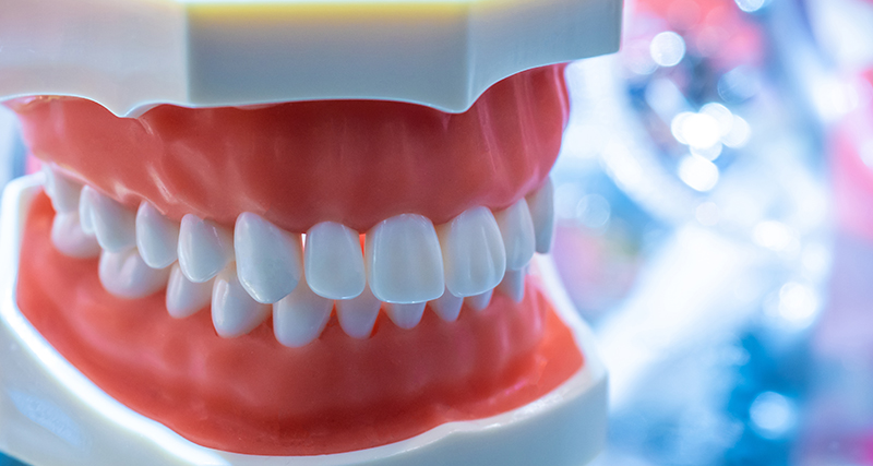 セラミック治療のメリット・デメリット