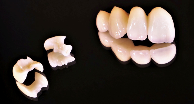 ホワイトニングについて