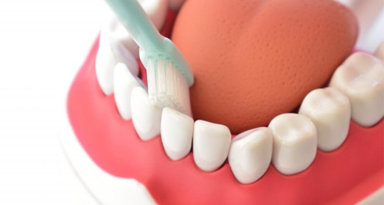 プラークってどんなもの？