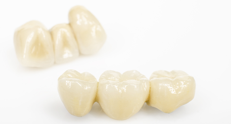 ホワイトニングについて