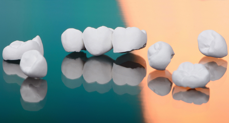 セラミック治療が保険治療より高額になる2つの理由