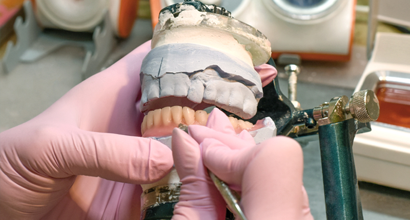 セラミック治療が保険治療より高額になる2つの理由