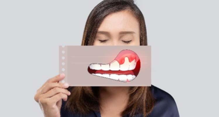 何日間くらい腫れる