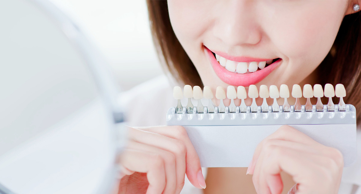 オフィスホワイトニング