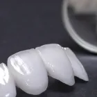 セラミック治療
