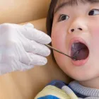 小児歯科