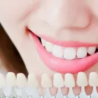 審美歯科