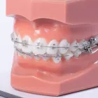 矯正